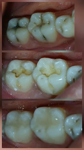 Pooja Smile Care Dental Gallery Image 30